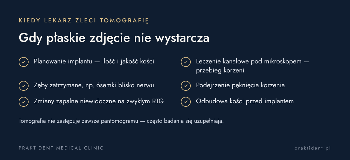 Kiedy lekarz zleca tomografię CBCT